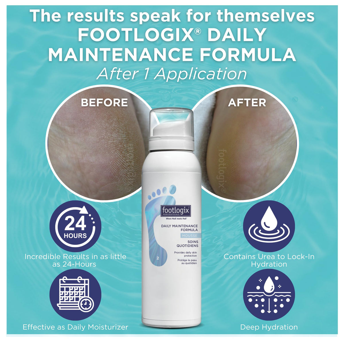 FOOTLOGIX dispensing mousse from pump for easy controlled use