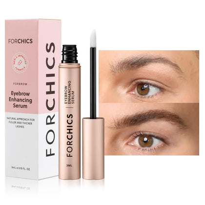ForChics product front packaging showing 3ml bottle and branding for clear purchase info