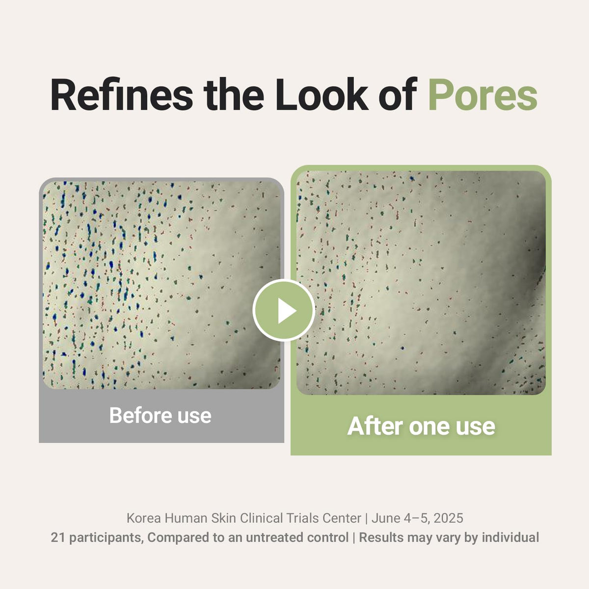FORETDERM soft foam in hand demonstrating gentle lathering benefit