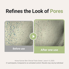 FORETDERM soft foam in hand demonstrating gentle lathering benefit