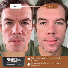Forge Skin label closeup highlighting ingredients and clean formulation transparency