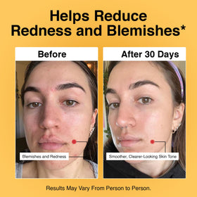 Foundation Skincare tube label detail with concentration and dermatologist-formulated badge