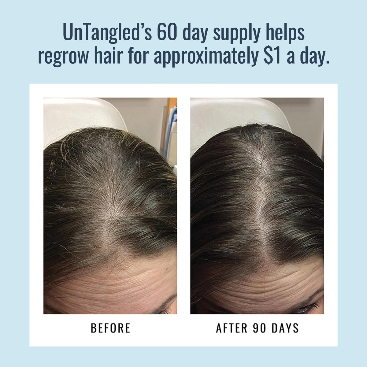 Foundation Skincare tablets in hand showing scale and easy swallow convenience