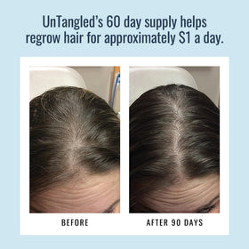 Foundation Skincare tablets in hand showing scale and easy swallow convenience
