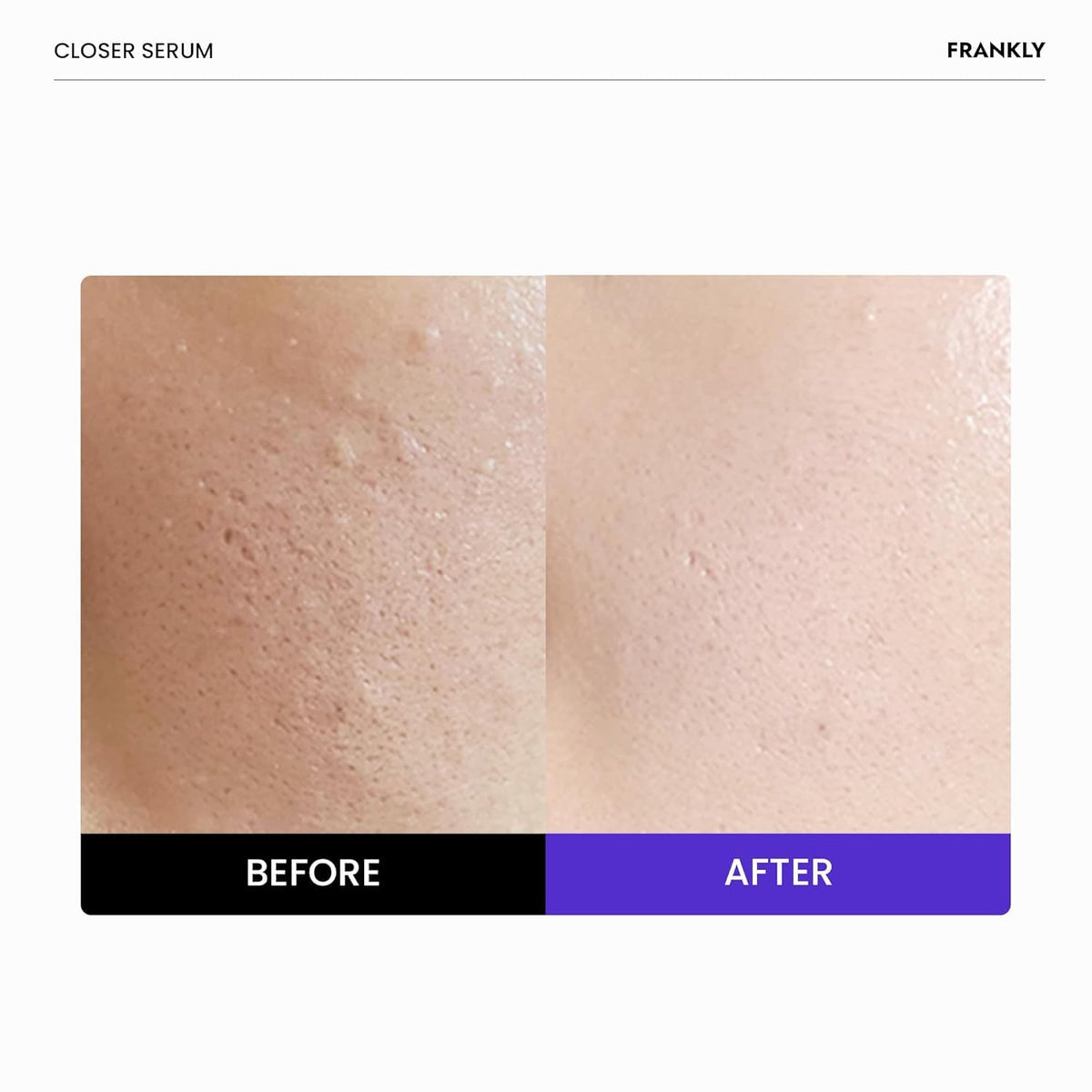 FRANKLY Closer Serum droplet texture closeup highlighting lightweight hydration