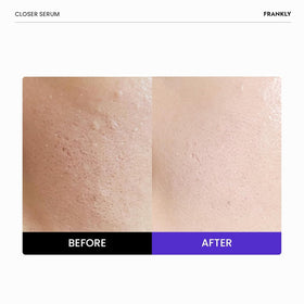 FRANKLY Closer Serum texture close-up on glass dropper for lightweight hydration