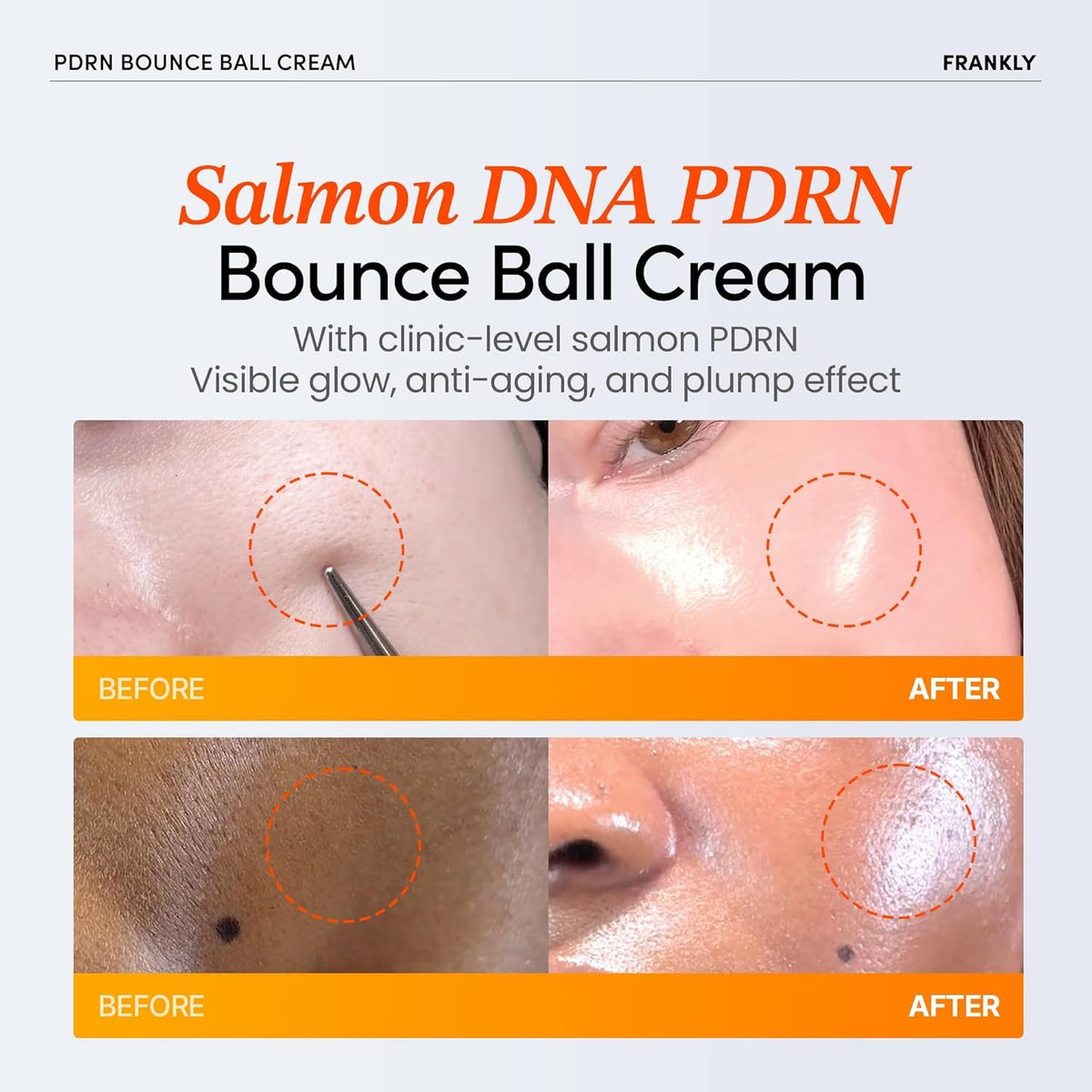 FRANKLY open jar with visible salmon PDRN balls, highlights fresh delivery