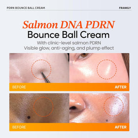 FRANKLY open jar with visible salmon PDRN balls, highlights fresh delivery