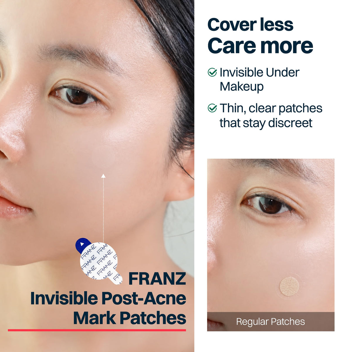 FRANZ patch blended under makeup zoom showing makeup-friendly concealment benefit