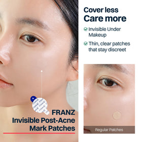 FRANZ patch blended under makeup zoom showing makeup-friendly concealment benefit