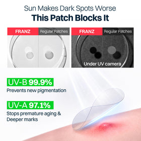 FRANZ two sizes 10mm and 12mm displayed for spot size versatility benefit