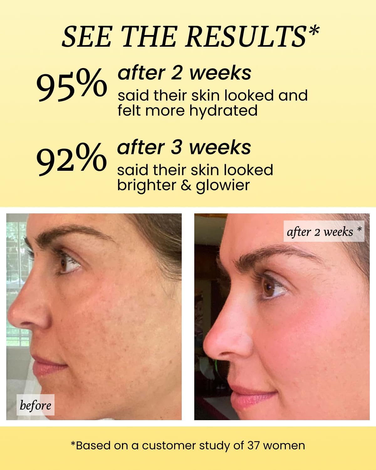 FRÉ face before and after showing evened tone and luminous glow