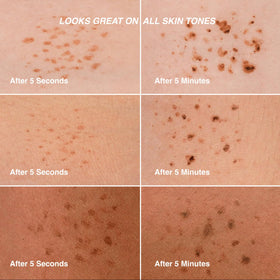 Freck Beauty Freck XL applied on nose and cheeks for sun-kissed look