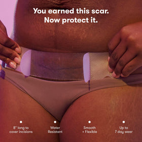 Frida Mom patch applied on postpartum abdomen showing discreet, comfortable wear