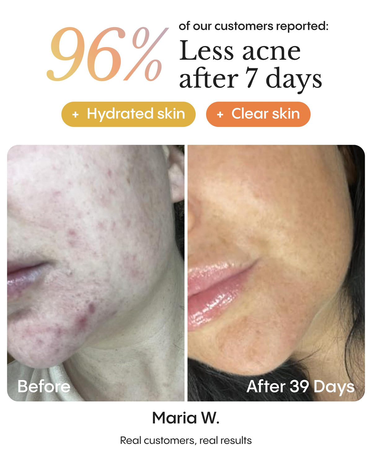 FRØYA balm application on fingertip demonstrating targeted use