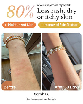 FRØYA balm on elbow showing overnight care for dry rough areas