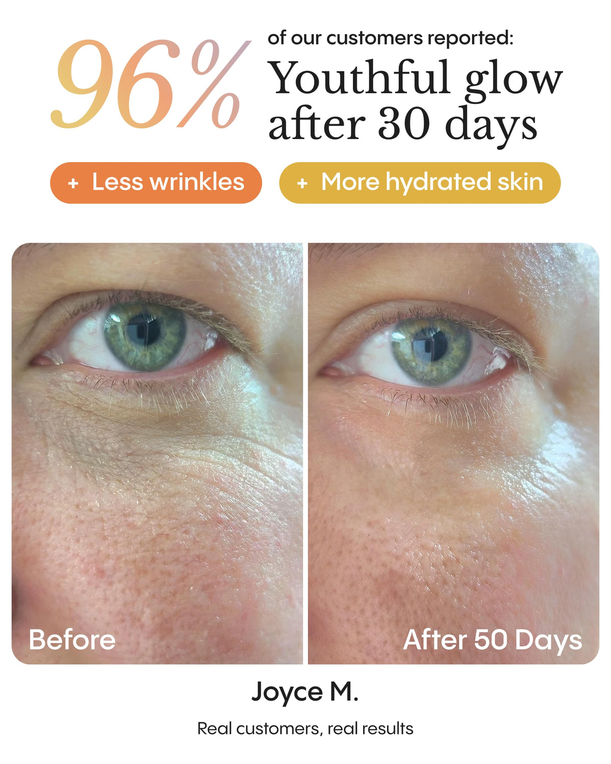 FRØYA applying balm under eye showing gentle patting technique for smoothing