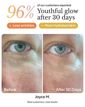 FRØYA applying balm under eye showing gentle patting technique for smoothing