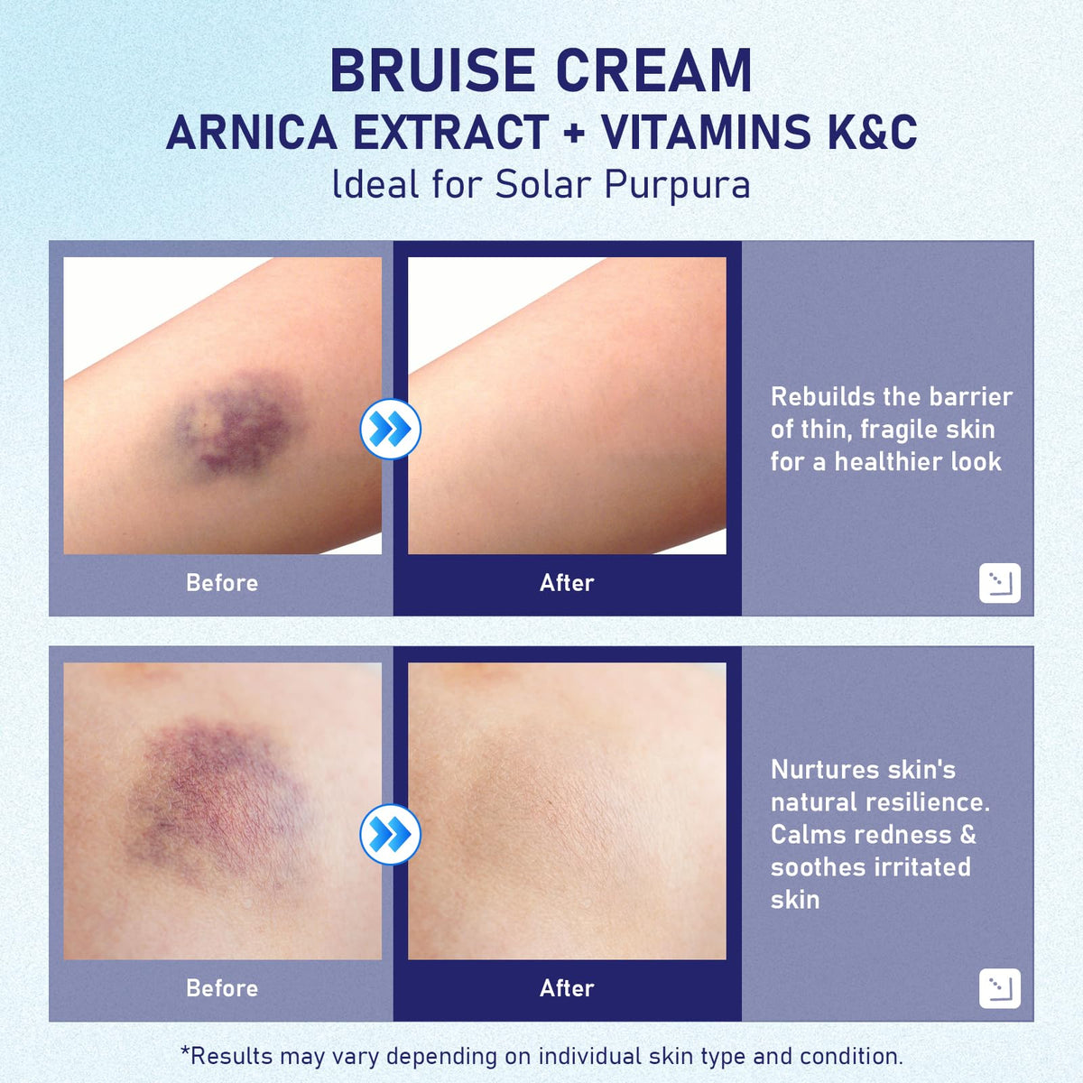 fugit cream beside a ruler to show 4 oz scale and travel-friendly size