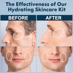 FULLLIGHT TECH eye cream tube detail emphasizing targeted smoothness around eyes