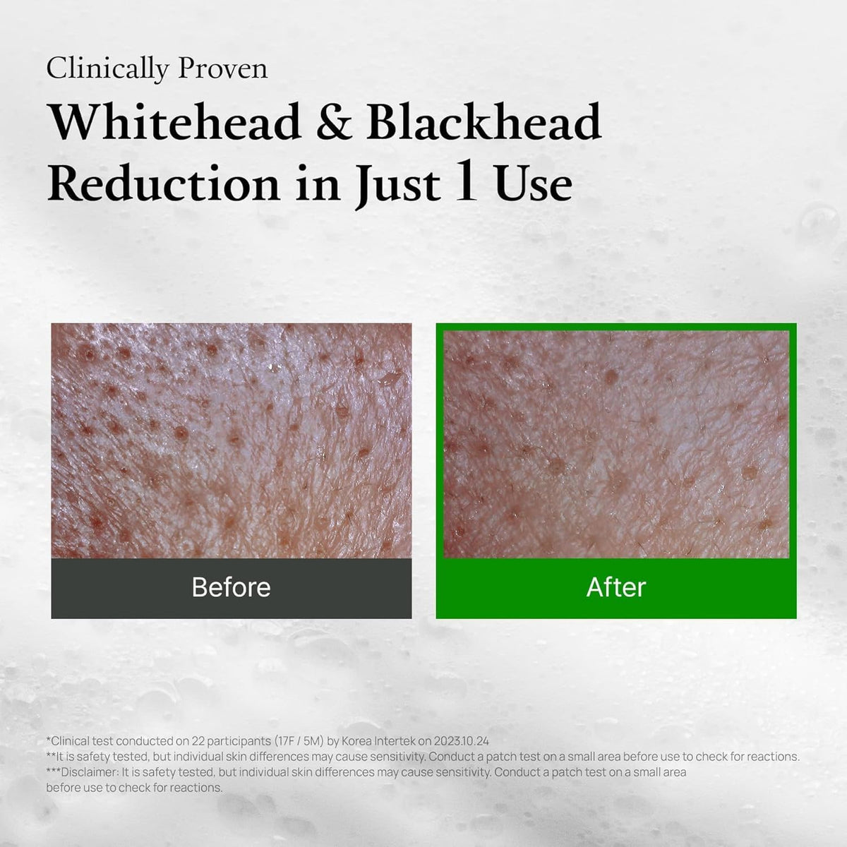 FULLY model wearing the mask demonstrating deep pore detox benefit