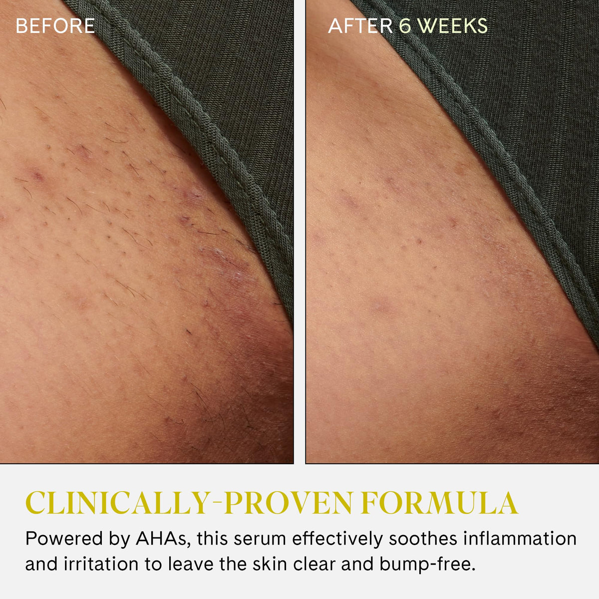 Fur label close-up highlighting AHA BHA ingredient benefits and transparency