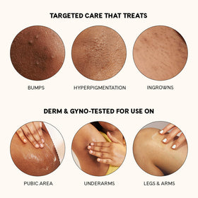 Fur rollerball used on bikini line to reduce visible ingrown bumps