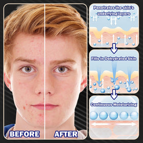 Man applying Fusang sheet mask to face for fast soothing and refreshment