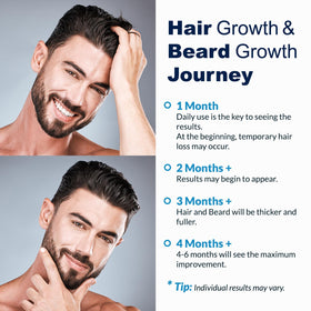 FUZYAT used as beard spray showing targeted follicle stimulation effort