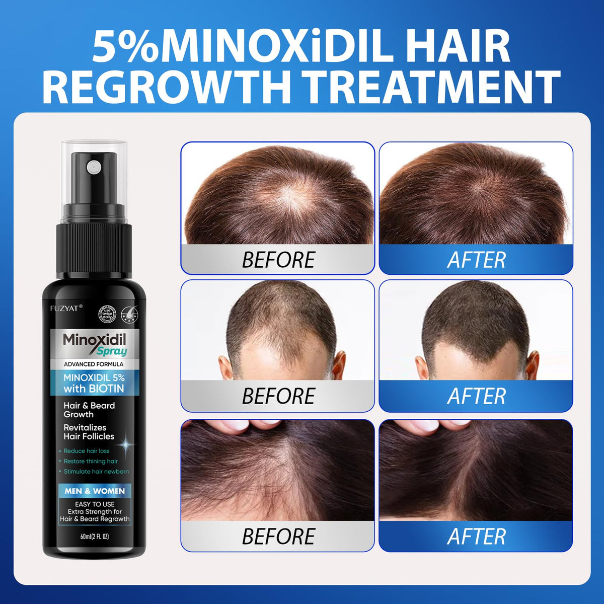 FUZYAT spray texture on scalp application highlighting lightweight absorption benefit