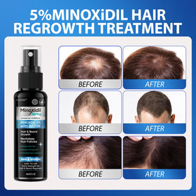 FUZYAT spray texture on scalp application highlighting lightweight absorption benefit