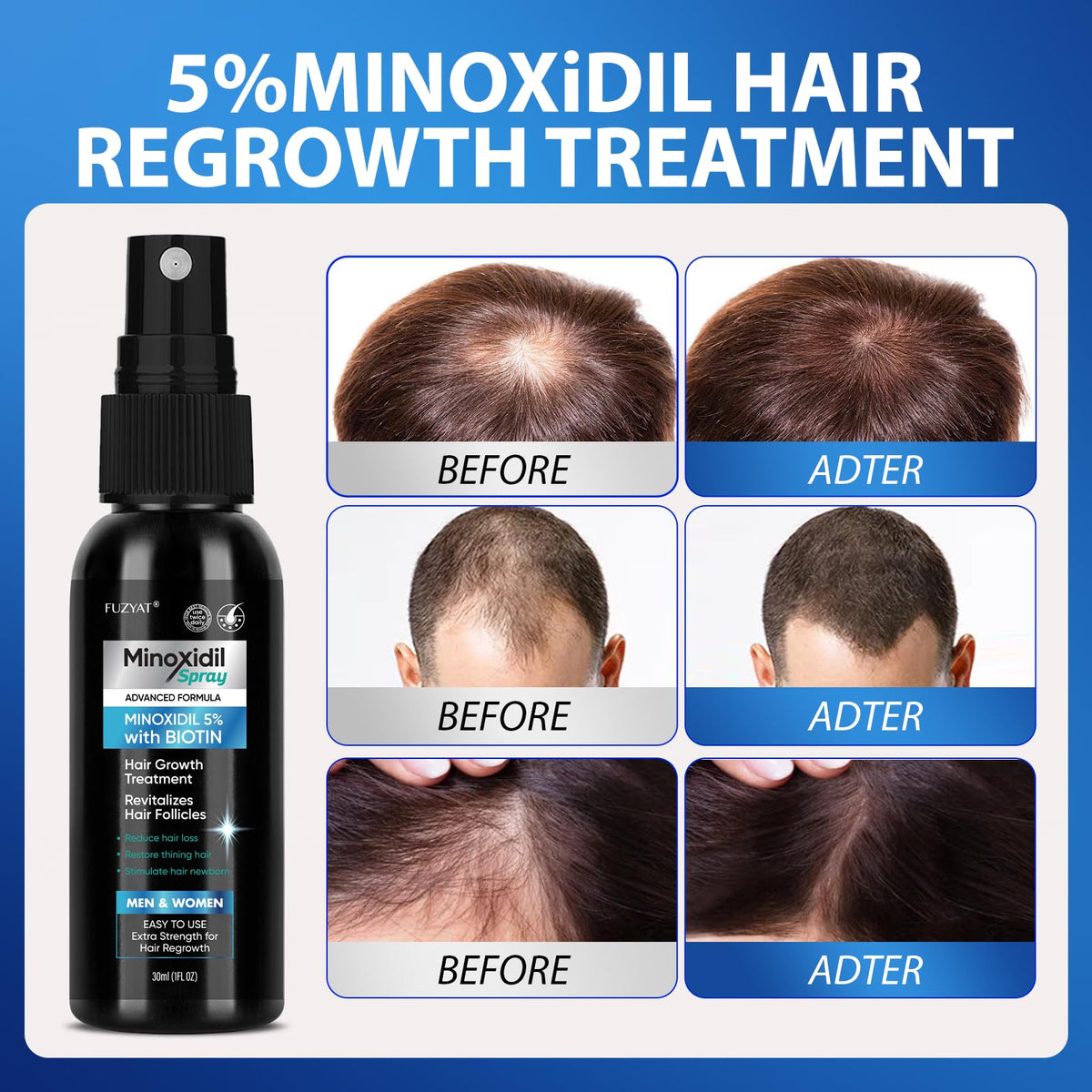 FUZYAT texture on scalp detail showing lightweight, non-greasy finish benefit