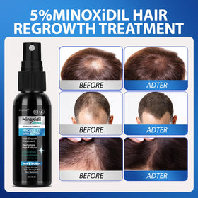 FUZYAT texture on scalp detail showing lightweight, non-greasy finish benefit