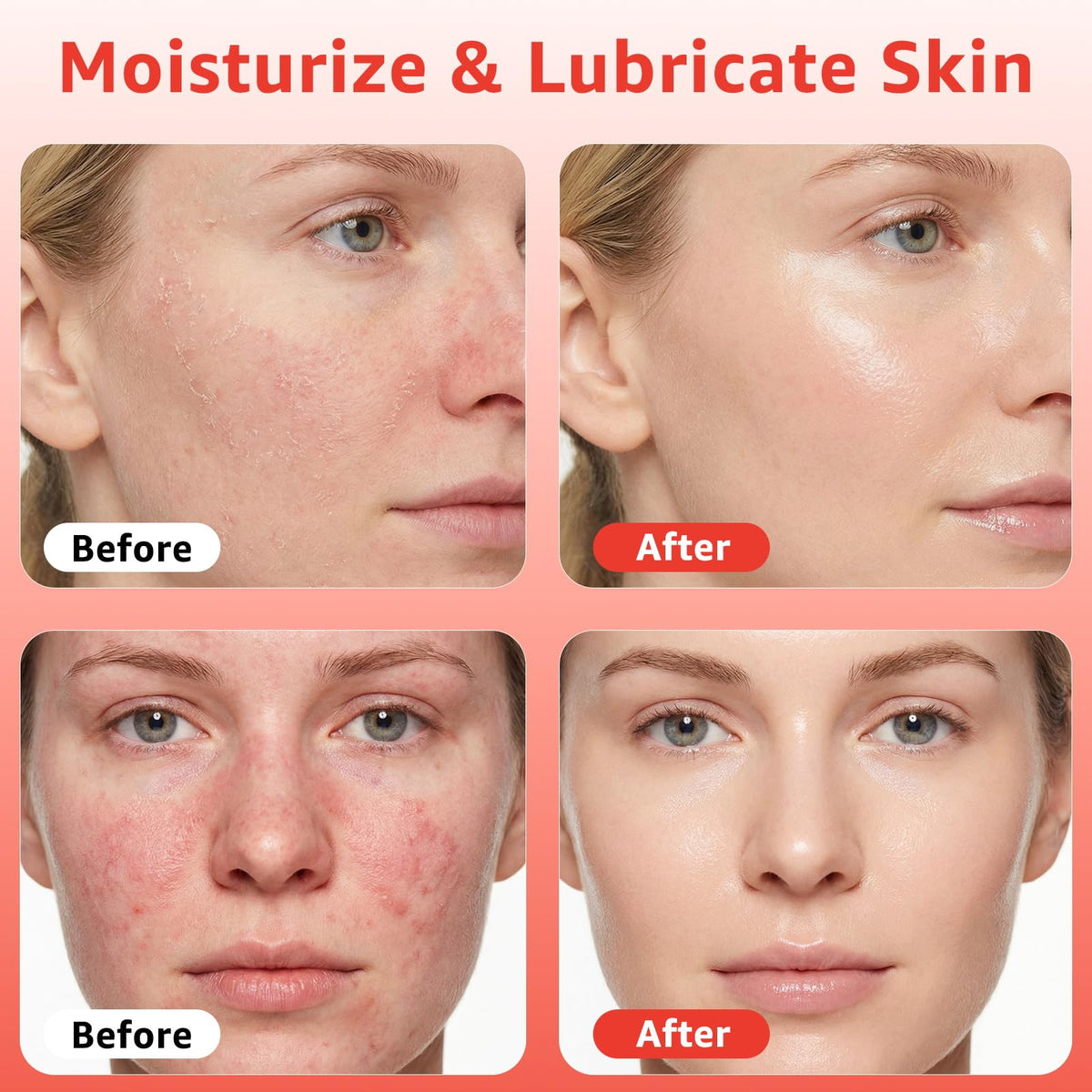 Fymiox dropper dispensing serum highlighting hyaluronic texture and fast absorption