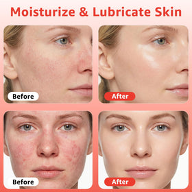 Fymiox dropper dispensing serum highlighting hyaluronic texture and fast absorption
