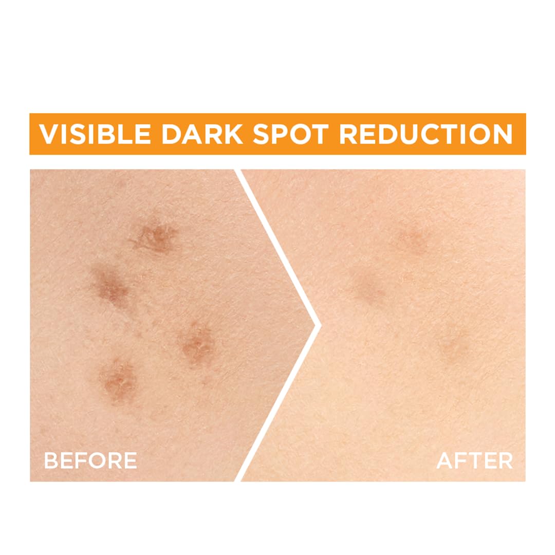 Garnier ingredient label showing Vitamin C and salicylic acid transparency benefit