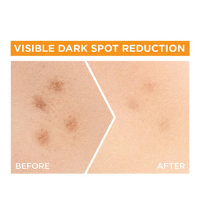 Garnier ingredient label showing Vitamin C and salicylic acid transparency benefit