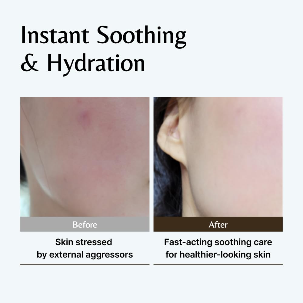 GD11 dispensing ampoule onto hand showing precise drop application for hydration