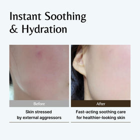 GD11 dispensing ampoule onto hand showing precise drop application for hydration