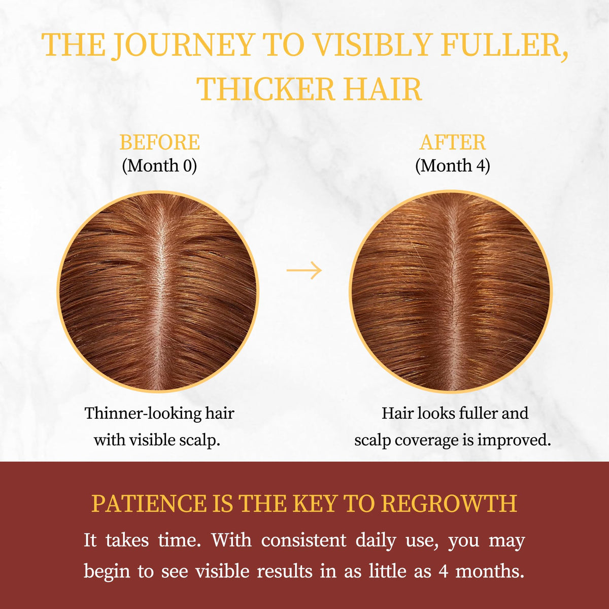 Gemächlich Zu Hause scalp application in use, demonstrates easy daily application
