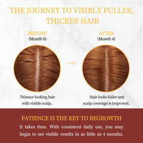 Gemächlich Zu Hause scalp application in use, demonstrates easy daily application
