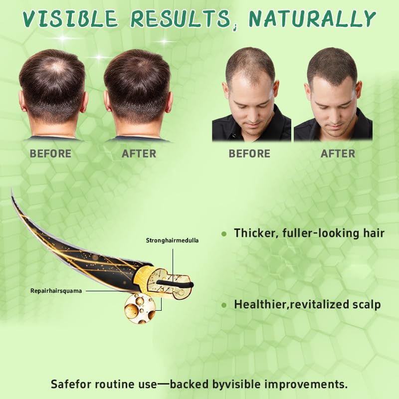 Generic brand applying serum to scalp in hand demonstrating easy massage benefit
