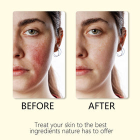 Generic balm rubbed into hands showing restored softness and protection