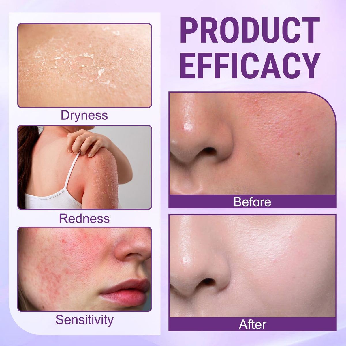 Generic Biotin cream on hand demonstrating spreadability and fast absorption benefit