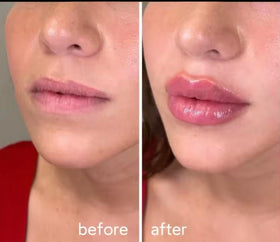 Generic extreme lipgloss on model lips showing instant plump and glossy sheen