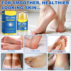 Generic before and after feet showing reduced calluses and visibly softer skin benefit