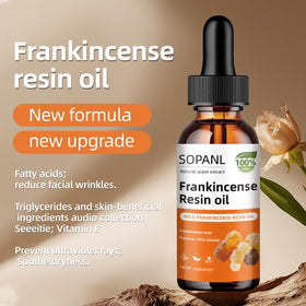 Generic frankincense bottle in hand for size comparison and easy use
