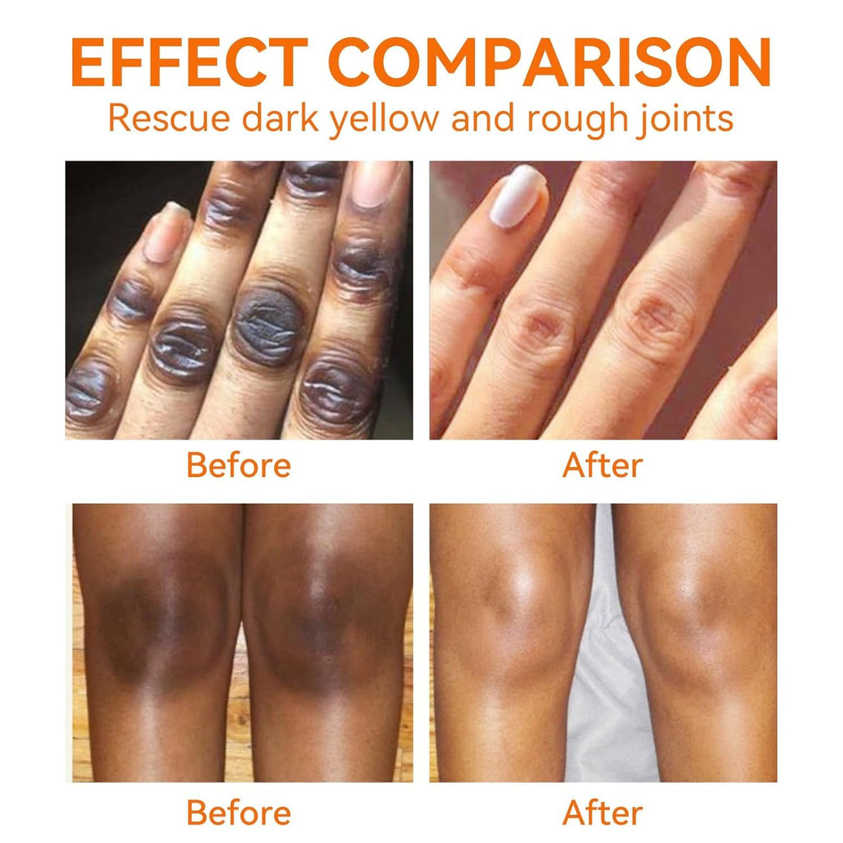 Generic before and after knees and elbows, highlights smoothing and hydrating benefit