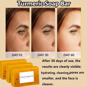 Generic brand individually wrapped lemon turmeric kojic soap, keeps bars fresh