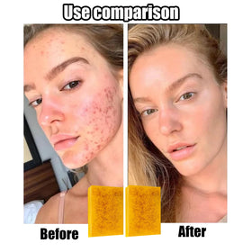 Generic brand close-up of textured exfoliating side, reveals fine particles